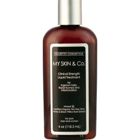 My Skin Liquid Treatment Mens 4 Oz